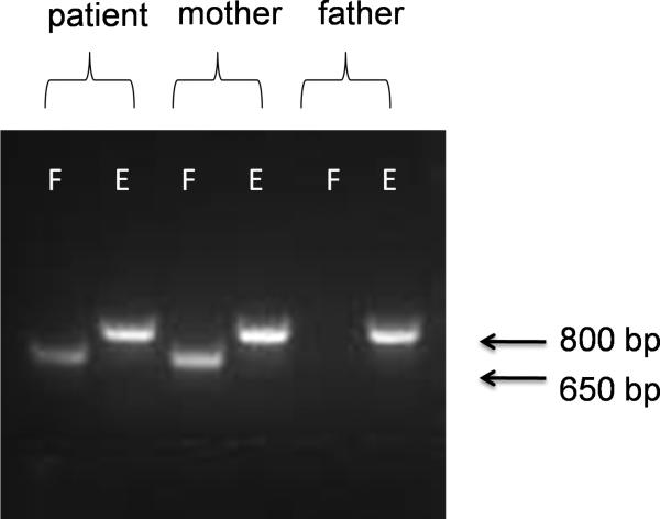 Fig. 1B