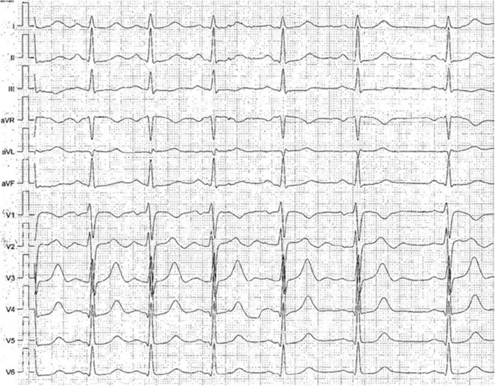 Fig. 2