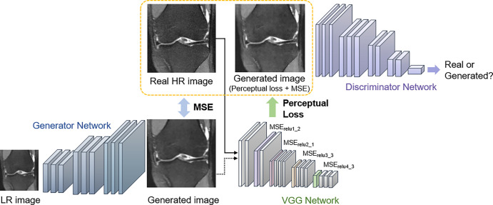 The overall structure of super-resolution generative adversarial network. Perceptual loss is defined by the following: the generated image and the real high-resolution (HR) image are passed through a VGG-16 (or -19) network (31). The distance between specific rectified linear unit (relu) layers is compared to preserve high-frequency details between the images, and the adversarial loss further pushes the generated image to follow the natural image manifold. LR = low-resolution, MSE = mean squared error. Images used were obtained from the NYU Langone Health fastMRI Dataset (fastmri.med.nyu.edu) (5,95).