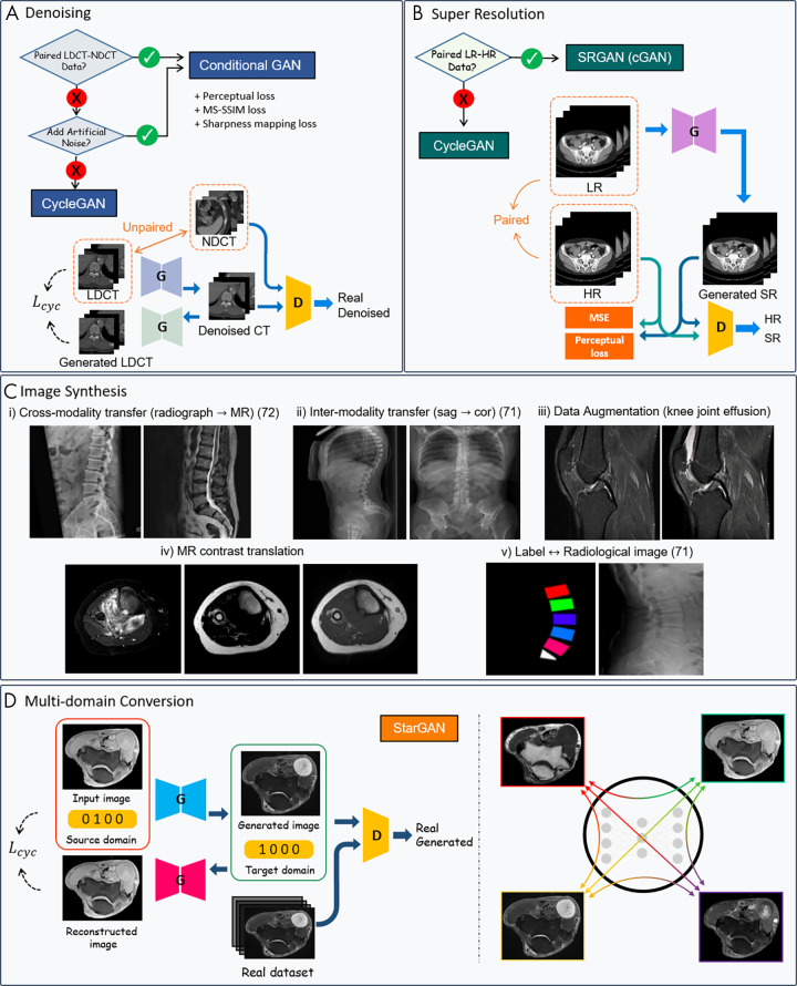 Overview of generative adversarial network (GAN) applications in musculoskeletal imaging. Figures are directly cropped from corresponding studies: A, GAN schemes for low-dose CT denoising with and without paired images. B, GAN schemes for super-resolution (SR) with and without paired images. C, Examples of GAN-based image synthesis: (i) Synthetic spine MR image from radiographic images (72); (ii) sagittal (sag) to coronal (cor) radiograph translation (71); (iii) joint effusion synthesis from CycleGAN—knee MR images from Clinical Hospital Centre Rijeka, Croatia (85); (iv) multicontrast domain translation in knee MR images—synthetic T1-weighted MR image from T2 fat map and T2 water map using conditional GAN; and (v) synthetic planar radiographs created from labels (71). D, Unpaired multicontrast MR image synthesis with StarGAN, multiple domain mapping using a single generator (89). Lcyc = cycle consistency loss, D = discriminator, G = generator, HR = high-resolution, LDCT = low-dose CT, LR = low-resolution, MSE = mean squared error, MS-SSIM = multiscale structural similarity, NDCT = normal-dose CT, SRGAN = super-resolution GAN.