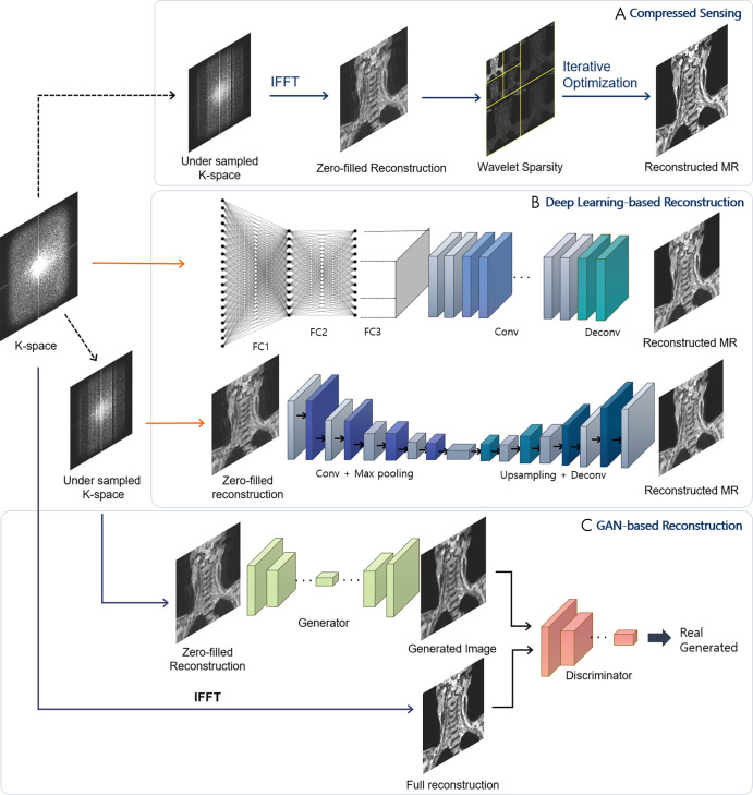 A schematic view of different architectures for MRI reconstruction. A, Compressed-sensing scheme. Starting from undersampled k-space data, the data are transformed to image and wavelet domains, and iterative optimization is applied to obtain full reconstruction. B, Deep learning–based reconstruction. Automated transform by manifold approximation (AUTOMAP) (27) uses fully connected (FC) layers with convolution layers to directly map k-space sensor data to image domain. Deep convolutional neural network models reconstruct MR images from zero-filled reconstructions. C, Generative adversarial network (GAN)–based reconstruction incorporates a discriminator to generate results closer to full reconstructions. IFFT = inverse fast-Fourier transform.