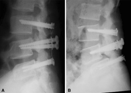 Fig. 1A–B