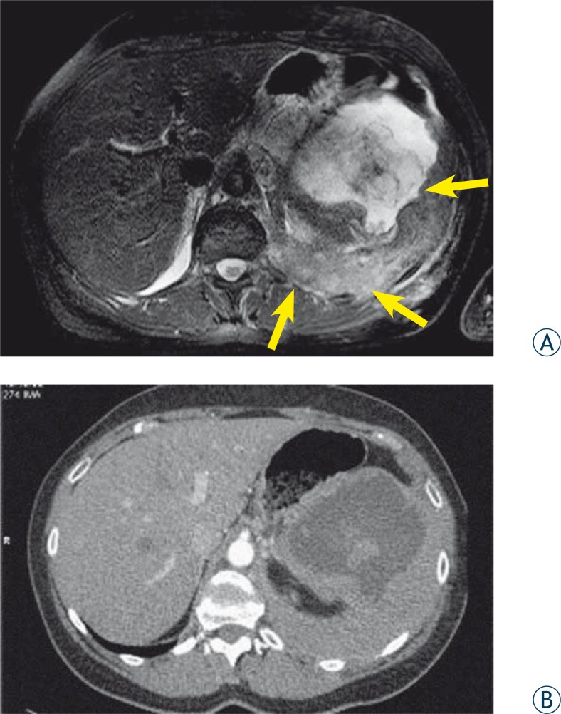 FIGURE 2 A, B