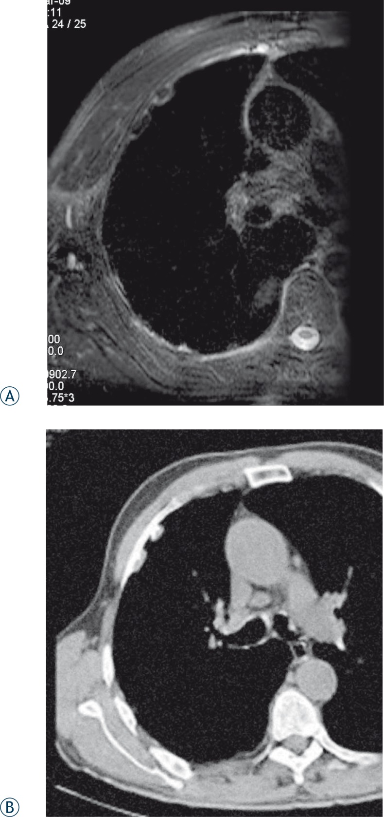 FIGURE 1 A, B