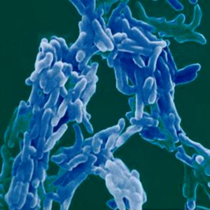 False-color image of
Mycobacterium tuberculosis
