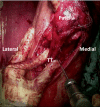 Fig 12