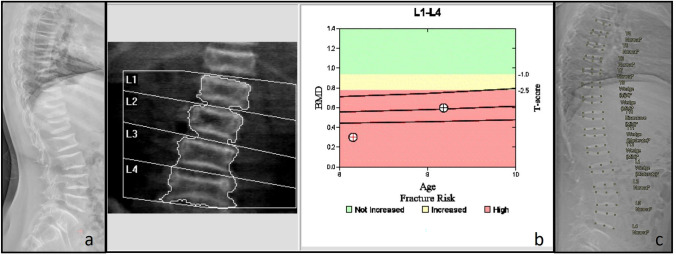 Fig. 2