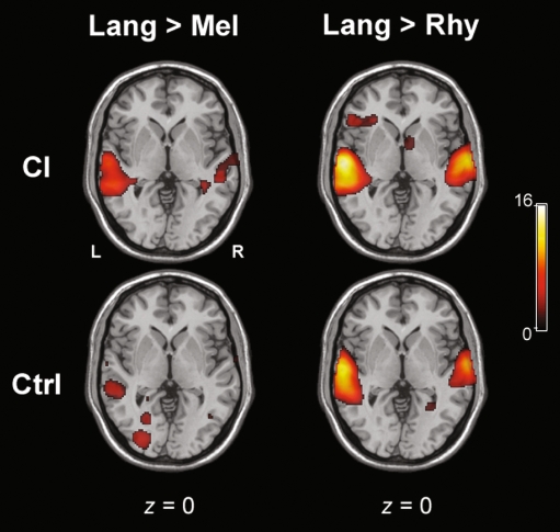 FIG. 4