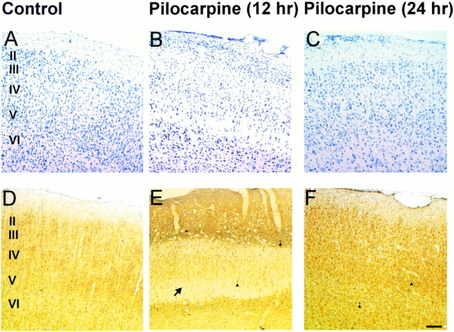 fig 6.