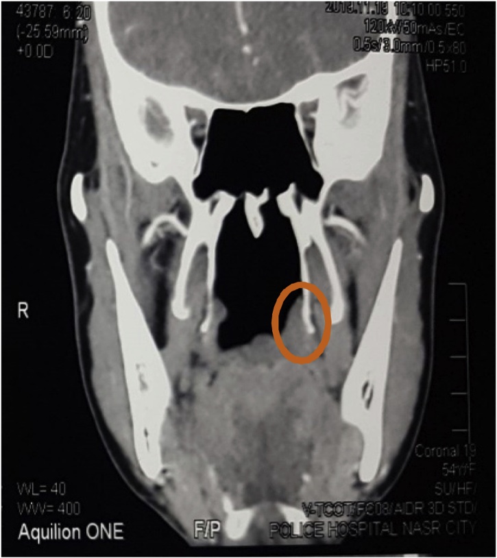 Fig. 1