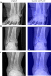 Fig. 6