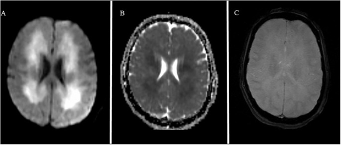 Fig. 2