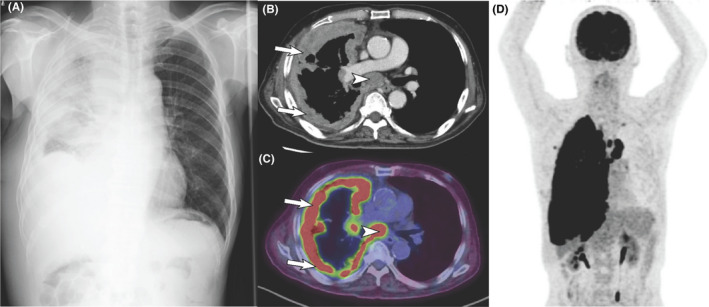 FIGURE 1