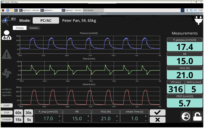 Figure 4. 