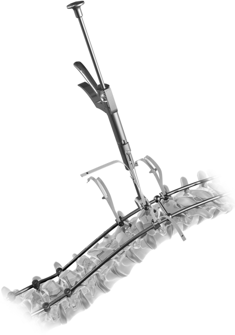 Fig. 3