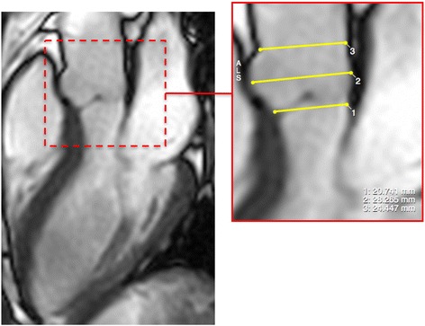 Fig. 3