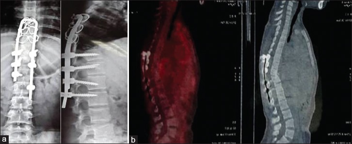 Figure 3B