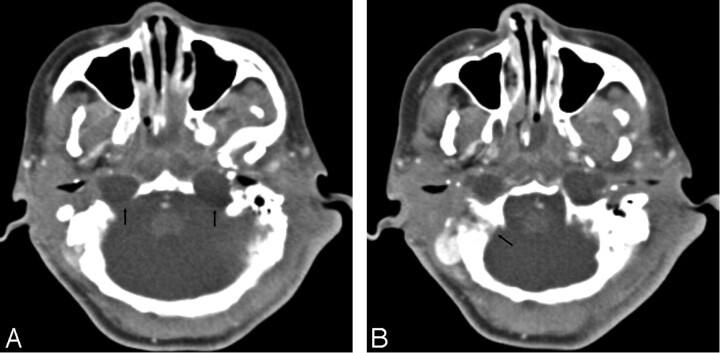 Fig 2.