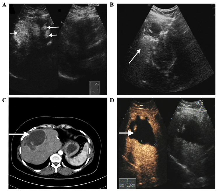 Figure 4.