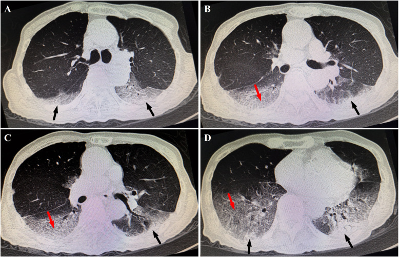 Fig. 1