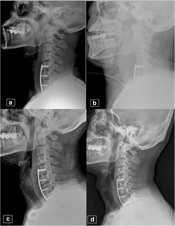 Fig. 2