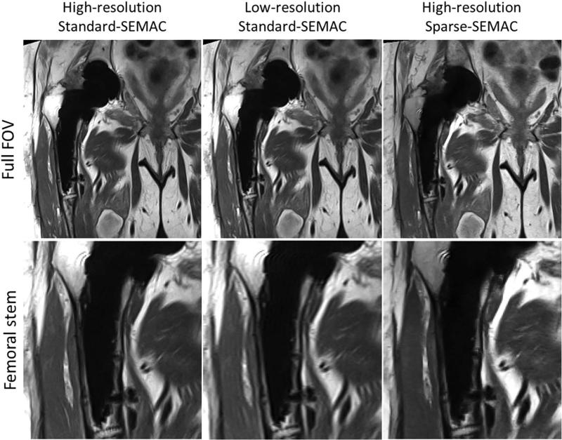 FIG. 6