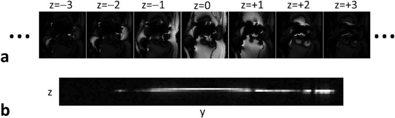 FIG. 1