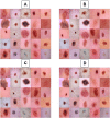 Fig 1