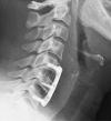Fig. 7