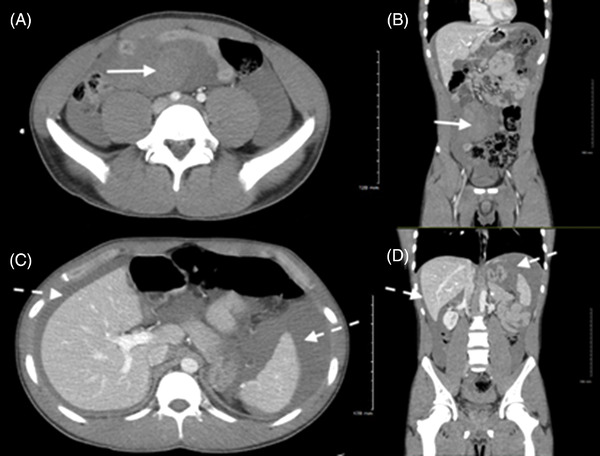 FIGURE 2