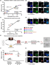 Figure 1. RAD51 score correlates with platinum chemotherapy response in established and patient-derived ovarian cancer cell lines and patient-derived organoids. A, Correlation between RAD51 score (percentage of geminin-positive cells with ≥5 RAD51 foci) and carboplatin sensitivity (IC50) determined by MTS assay in HGSOC cell lines. B, Representative images of geminin, RAD51, and colocalization of geminin/RAD51 at ×10 with ×63 insets in two established ovarian cancer cell lines. All foci were counted in 2 technical replicates with n > 100 geminin-positive cells per experiment; scale bars, 50 μm. C, Correlation between RAD51 score and carboplatin sensitivity (IC50) determined by MTS assay in patient-derived HGSOC cell lines. D, Representative images of geminin, RAD51, and colocalization of geminin/RAD51 at ×10 with ×63 insets in 1 POV cell line. All foci were counted in 2 technical replicates with n > 100 geminin-positive cells per experiment; scale bars, 50 μm. E, Organoid generation from ovarian cancer tumor or ascites and representative brightfield microscopic image of ovarian cancer organoids after 7 days of growth; scale bars, 100 μm. F, RAD51 scores in platinum-responsive and platinum-nonresponsive patient-derived ovarian cancer organoids before and after irradiation. Error bars indicate ± SD. *, P < 0.05 and ****, P < 0.0001 by Student two-tailed t test. All foci were counted in 2 technical replicates with n > 100 geminin-positive cells per experiment. G, Representative images of geminin, RAD51, and colocalization of geminin/RAD51 at ×10 with ×63 insets; scale bars, 10 μm.