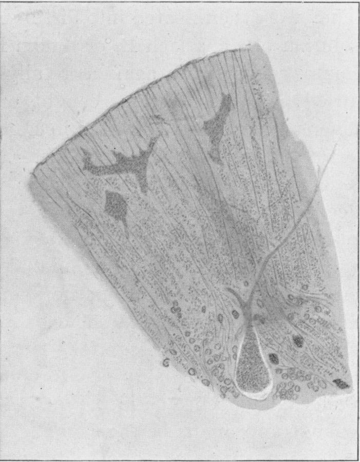 Fig. 16