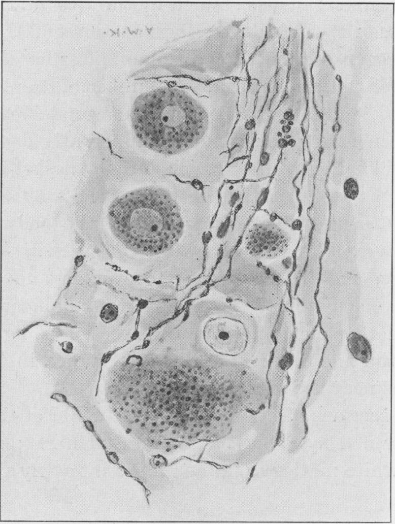 Fig. 14