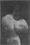 551
