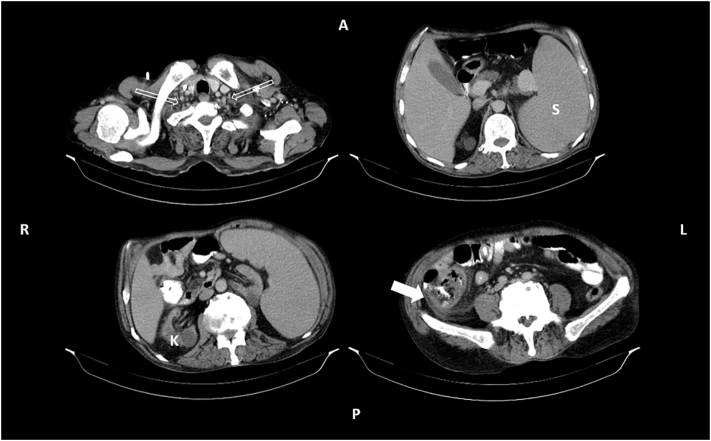 Fig. 1