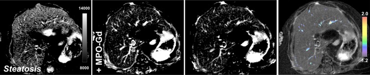 Figure 4b: