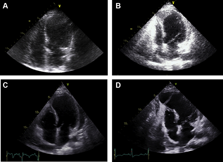 Figure 2