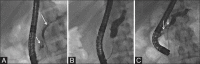Figure 10 (A-C)