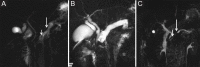 Figure 9 (A-C)