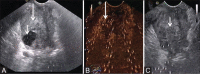 Figure 4 (A-C)