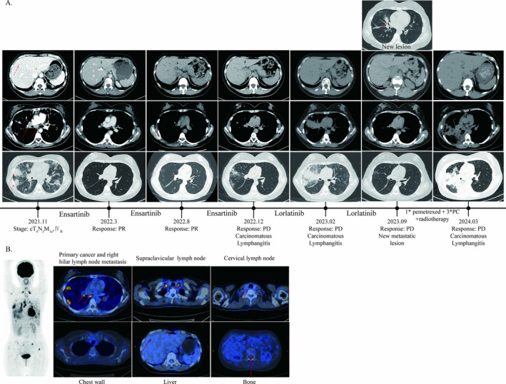 FIGURE 2