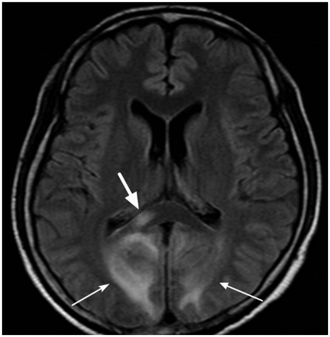 Fig. 15