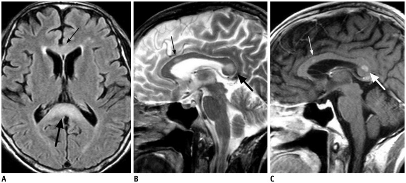 Fig. 16