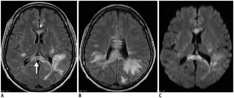 Fig. 14