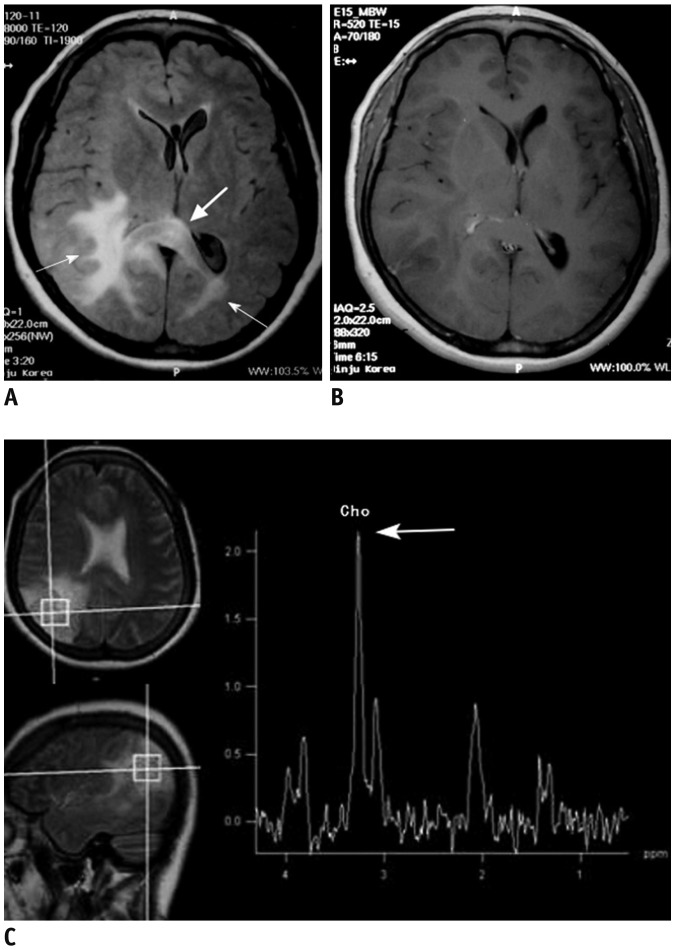 Fig. 11