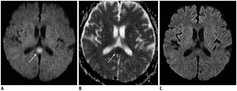 Fig. 17