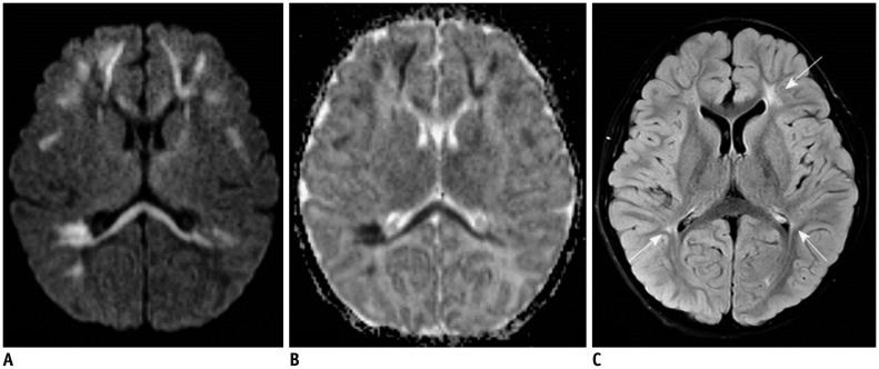 Fig. 18