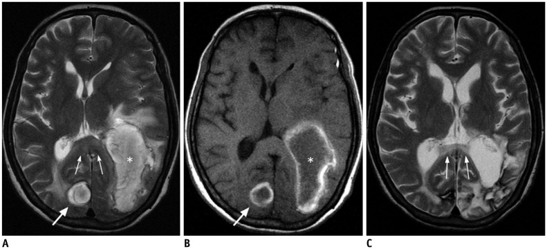 Fig. 13