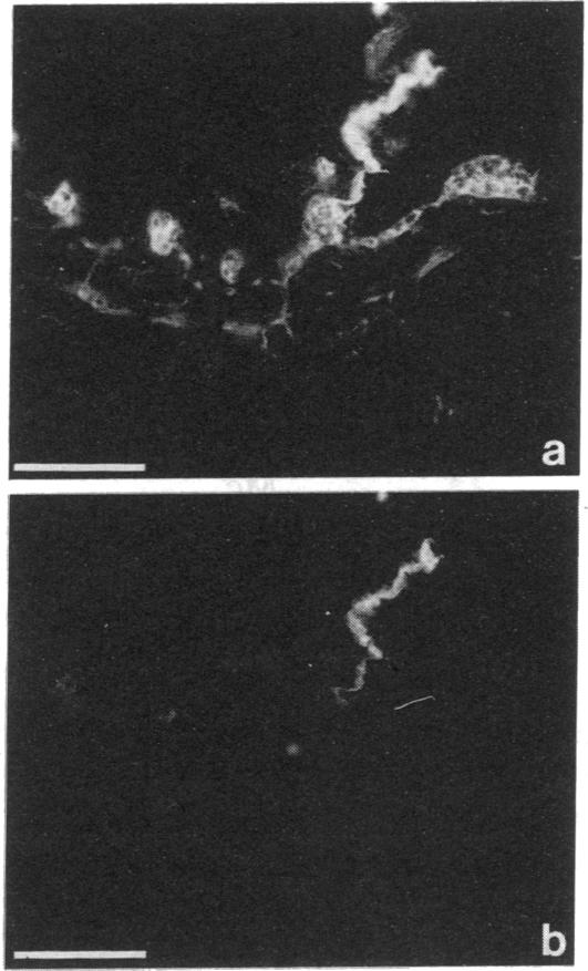 graphic file with name pnas01064-0430-a.jpg