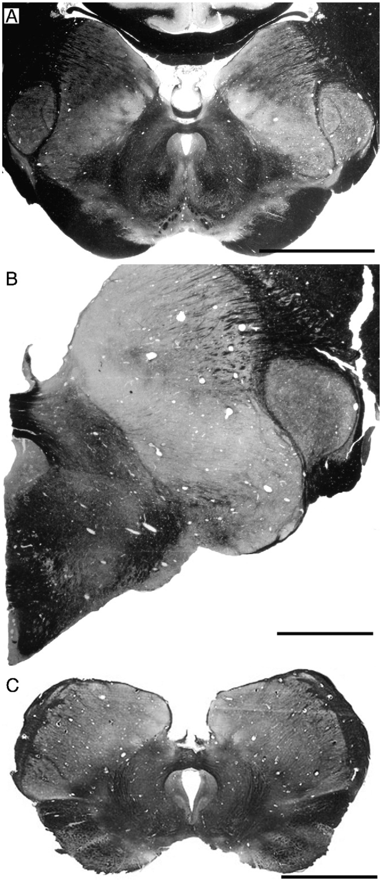 Fig. 12.